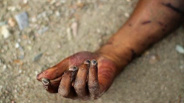 How A Man Got Electrocuted While Attempting To Steal Armoured Cables In Jigawa